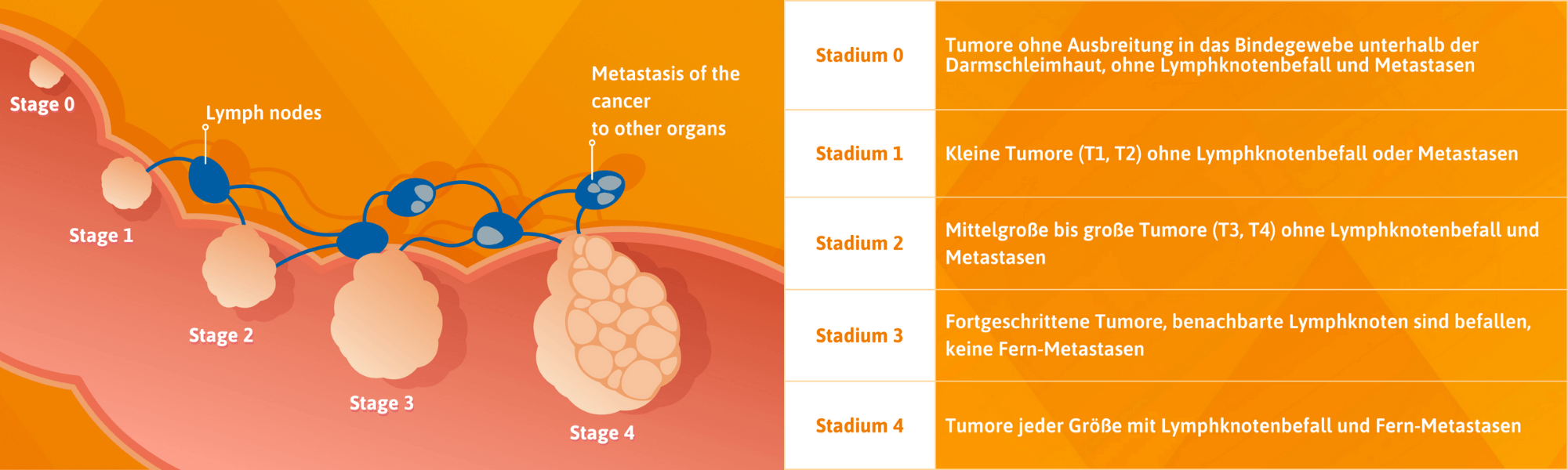 Stadium 0: Tumore ohne Ausbreitung in das Bindegewebe unterhalb der Darmschleimhaut, ohne Lymphknotenbefall und Metastasen. Stadium 1: Kleine Tumore (T1, T2) ohne Lymphknotenbefall oder Metastasen. Stadium 2: Mittelgroße bis große Tumore (T3, T4) ohne Lymphknotenbefall und Metastasen. Stadium 3: Fortgeschrittene Tumore, benachbarte Lymphknoten sind befallen, keine Fern-Metastasen. Stadium 4: Tumore jeder Größe mit Lymphknotenbefall und Fern-Metastasen