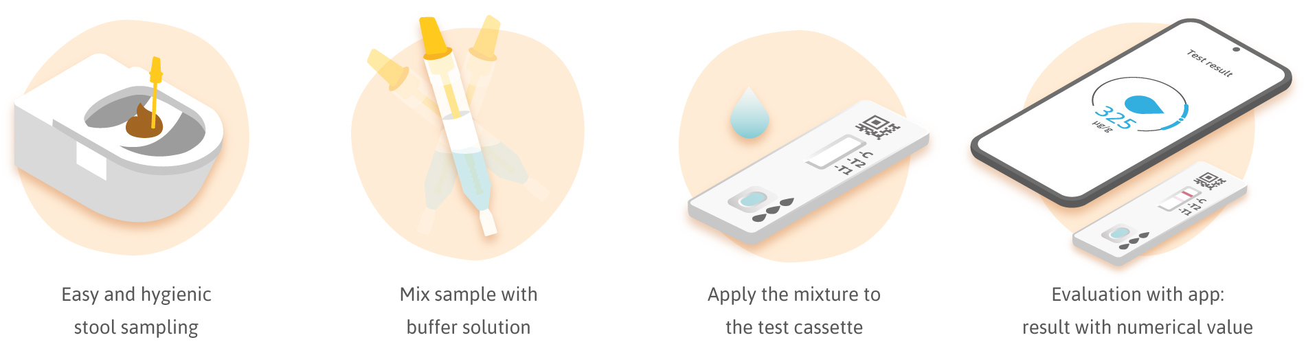 Quick guide to a stool test for fecal calprotectin, from stool sample collection to evaluation using a smartphone.