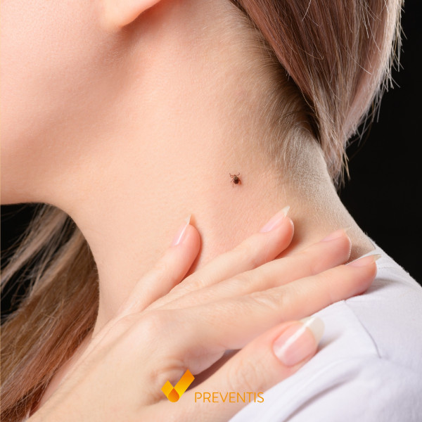 Image pour l'article Not every tick bite leads to a Lyme disease infection