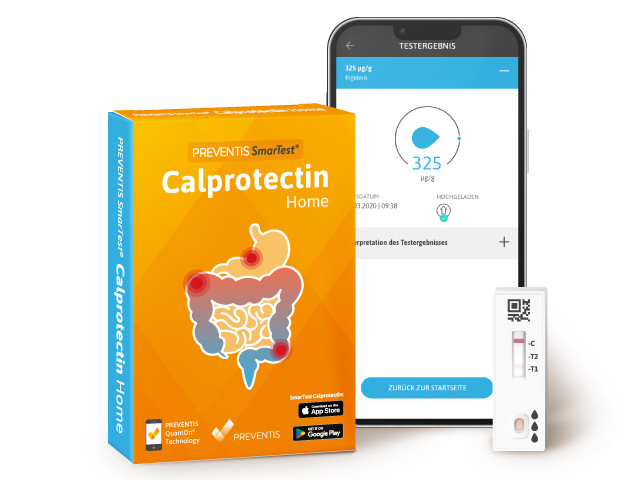 Verpackung des Selbsttests SmarTest Calprotectin Home für CED-Erkrankte; daneben ein Smartphone mit dem Calprotectin-Wert auf dem Bildschirm und eine Schnelltestkassette.